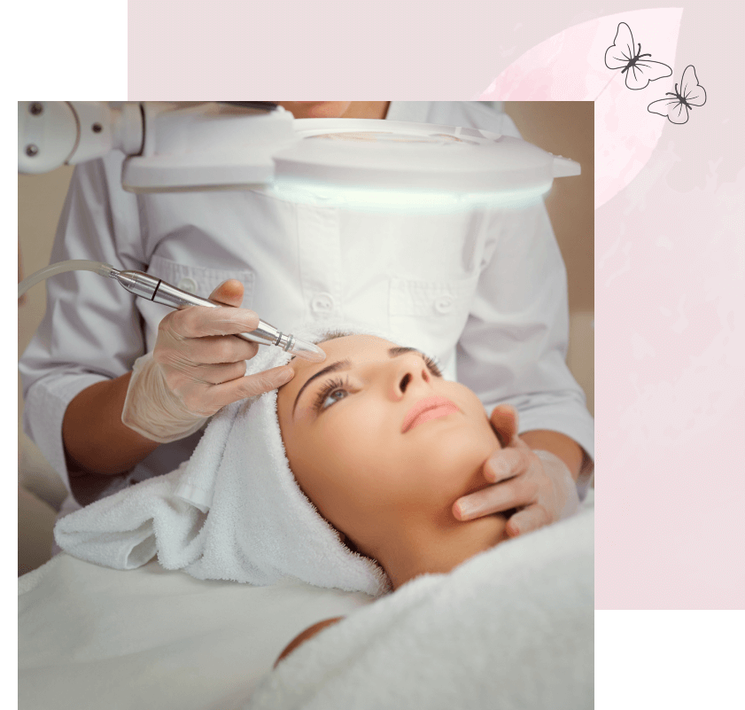 microneedling-beaute-depil-beauty-chastre microneedling-beaute-depil-beauty-chastre